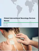 Global Interventional Neurology Devices Market 2017-2021